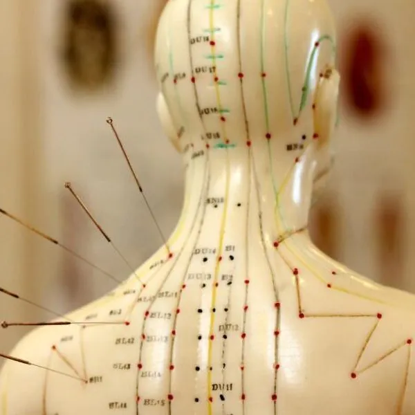 modern-acupuncture